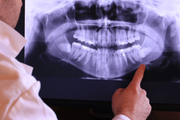 Best Emergency Treatment for Toothache in Hamburg, PA